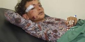 مقتل مدني واصابة طفل بانفجار لغم بمحافظة تعز